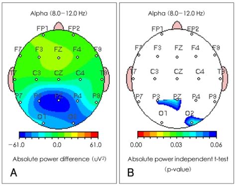 What is EEG absolute power? Absolute power, defined as<strong> total energy intensity of an electrode on a certain region at different frequency bands8. . Absolute power eeg